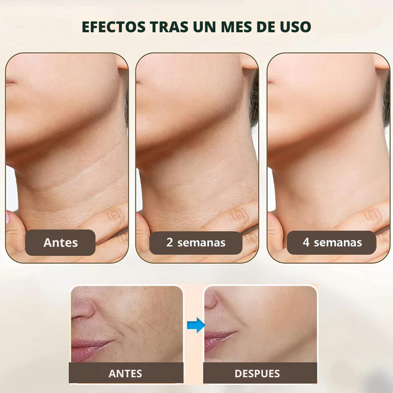 Dispositivo reductor de Arrugas e Imperfecciones -  Lifting Facial™