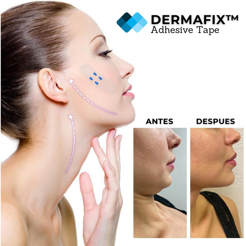 Fijación Dermatológica Avanzada - DermaFix™ Adhesive Tape