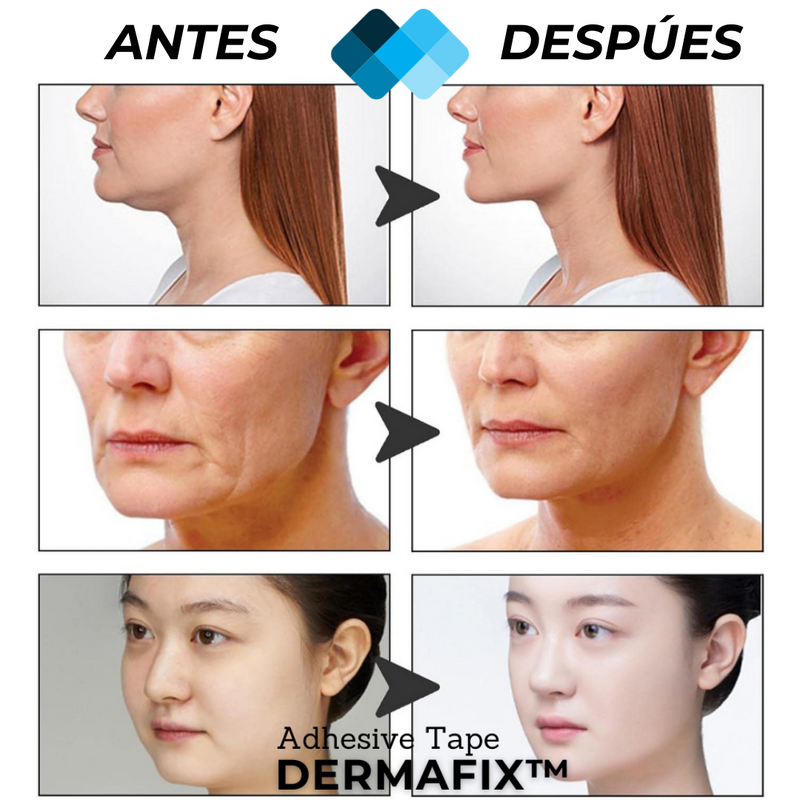 Tiras Lifting facial Anti-edad l 60 Unidades Transparentes